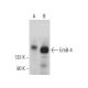 ErbB4/HER4 Antibody (G-6) - Western Blotting - Image 377571