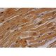 ErbB4/HER4 Antibody (HFR1) - Immunohistochemistry - Image 357577
