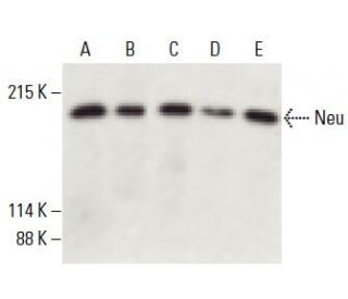 ErbB2/HER2 Antibody (F-11) - Western Blotting - Image 398252 