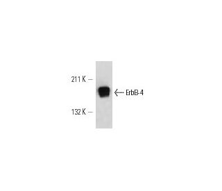 ErbB4/HER4 Antibody (HFR1) - Western Blotting - Image 12968