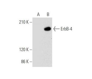 ErbB4/HER4 Antibody (A-5) - Western Blotting - Image 319623