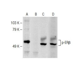 Estrogen Receptor beta Antibody (1531) - Western Blotting - Image 147934