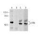Estrogen Receptor beta Antibody (1531) - Western Blotting - Image 147934