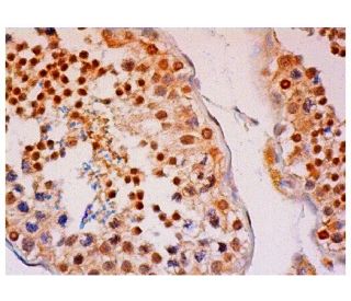 Estrogen Receptor beta Antibody (B-3) - Immunohistochemistry - Image 313297 