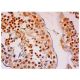 Estrogen Receptor beta Antibody (B-3) - Immunohistochemistry - Image 313297 