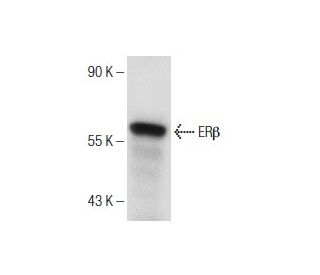 western blotting image from recommended Estrogen Receptor beta (B-3) monoclonal antibody replacement. Image 150955