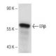 western blotting image from recommended Estrogen Receptor beta (B-3) monoclonal antibody replacement. Image 150955