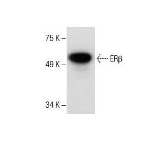 western blotting image from recommended Estrogen Receptor beta (B-1) monoclonal antibody replacement. Image 287465
