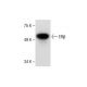 This polyclonal antibody has been discontinued. See our recommended <a href="erbeta-antibody-b-1">Estrogen Receptor beta (B-1)</a> monoclonal antibody (sample data shown). western blotting image from recommended Estrogen Receptor beta (B-1) monoclonal antibody replacement. Image 287465