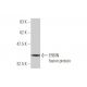 ERBIN Antibody (10D2) - Western Blotting - Image 350232