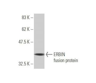 western blotting image from recommended ERBIN (10D2) monoclonal antibody replacement. Image 350232