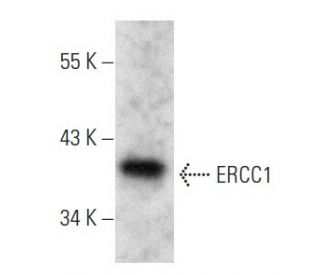 ERCC1 Antibody (3H11) - Western Blotting - Image 354303 