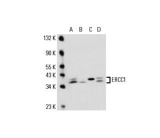 ERCC1 Antibody (8F1) - Western Blotting - Image 17499 