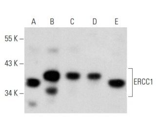 western blotting image from recommended ERCC1 (D-10) monoclonal antibody replacement. Image 354323