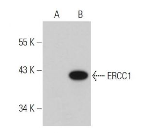 ERCC1 Antibody (8F1) - Western Blotting - Image 38114