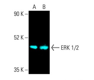 E.R.Kページ 2020 KAWASAKI ZX ER400 D | JKAERKD12LDA73973