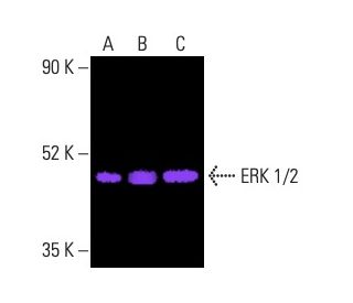 E.R.Kページ Anti-ERK1 (phospho Thr202/Tyr204) + ERK2 (phospho Thr185