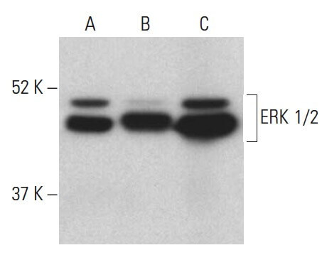 erkさま erk-1-2-antibody-mk1-western-