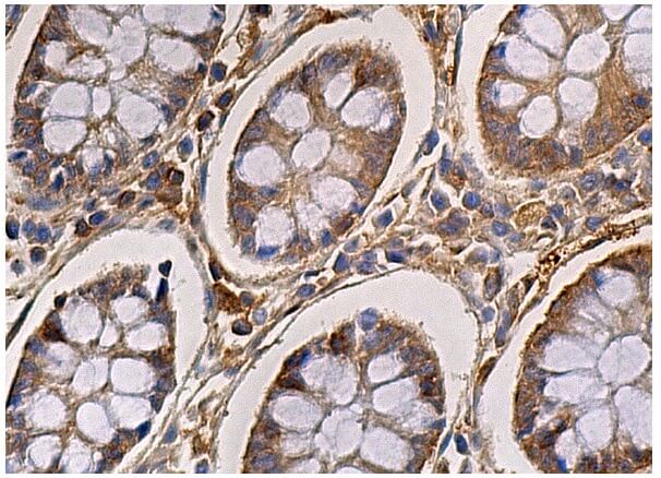 ERK 1 Antibody (E-6) | SCBT - Santa Cruz Biotechnology