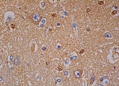 ERK 1 Antibody (E-6) | SCBT - Santa Cruz Biotechnology