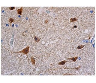E.R.Kページ ERK 1 Antibody (G-8) | SCBT - Santa Cruz Biotechnology