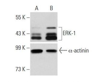 ERK 1 shRNA Plasmid (h): sc-29307-SH. Western blot analysis of human ERK-1 expression in ERK-1 shRNA Plasmid transfected (