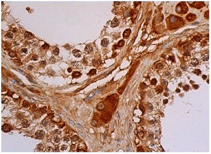 ERK 2 Antibody (C-8) | SCBT - Santa Cruz Biotechnology