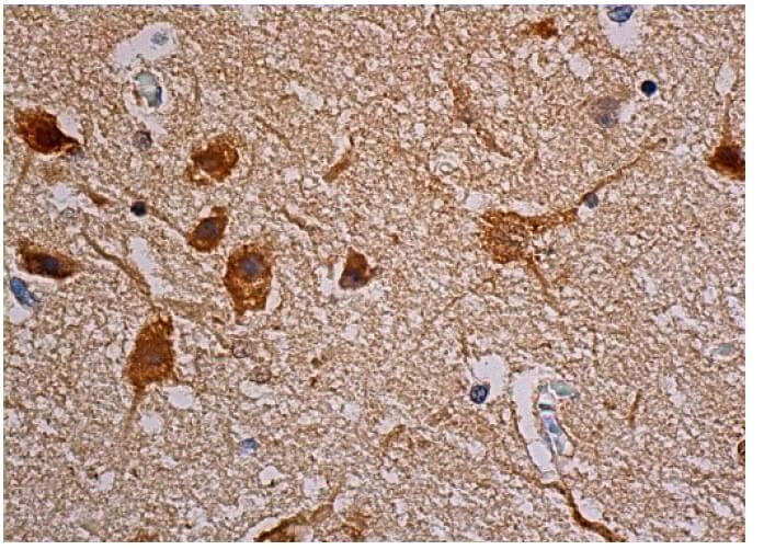 ERK 2 Antibody (C-8) | SCBT - Santa Cruz Biotechnology