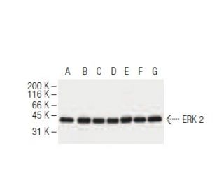 ERK 2 Antibody (6H3) - Western Blotting - Image 62904 