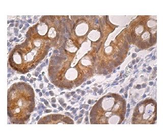 immunohistochemistry image from recommended ERK 3 (B-10) monoclonal antibody replacement. Image 160303