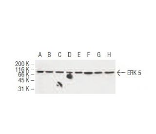 ERK 5 Antibody (12F2) - Western Blotting - Image 62905 