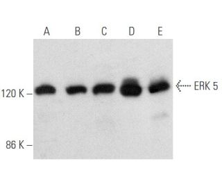western blotting image from recommended ERK 5 (C-7) monoclonal antibody replacement. Image 354697