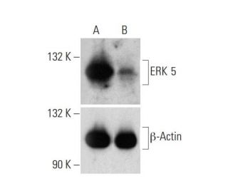 ERK 5 HDR Plasmid (h): sc-400891-HDR. Western blot analysis of ERK 5 expression in non-transfected control (A) and puromycEach CRISPR/Cas9 Knockout (KO) Plasmid product consists of a pool of 3 plasmids designed to ensure identification and cleavage of a specific gene for maximum knockout efficiency. Each plasmid encodes a unique 20 nt sequence derived from the GeCKO (v2) library.