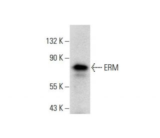 western blotting image from recommended ERM (H-06) monoclonal antibody replacement. Image 138614