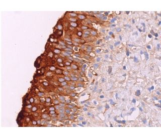 Ero1-Lα Antibody (D-7) | SCBT - Santa Cruz Biotechnology