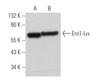 Ero1-Lα Antibody (D-7) | SCBT - Santa Cruz Biotechnology