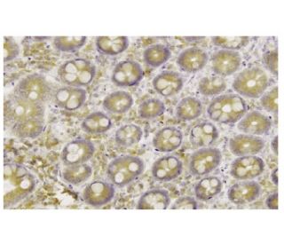 Ero1-Lα Antibody (YW-8) | SCBT - Santa Cruz Biotechnology