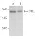 ERRα Antibody (2ERR37) - Western Blotting - Image 15777
