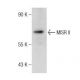 MISR II (H-150): sc-67287. Western blot analysis of MISR II expression in ES-2 whole cell lysate. 
