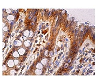 immunohistochemistry image from recommended ESE-1 (E-8) monoclonal antibody replacement. Image 158899