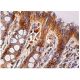 immunohistochemistry image from recommended ESE-1 (E-8) monoclonal antibody replacement. Image 158899