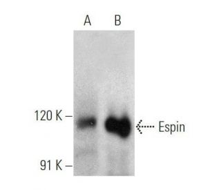 Espin Antibody (E-1) - Western Blotting - Image 356205 