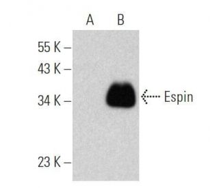 Espin Antibody (E-1) - Western Blotting - Image 356207