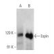 Espin Antibody (E-1) - Western Blotting - Image 356205 