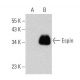 Espin Antibody (E-1) - Western Blotting - Image 356207