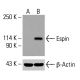 BRCAA1 항체 (C-8): sc-515650. 미처리 HeLa (A), 화학 처리된 HeLa (B, C) 및 HCT-116 (D)의 완전 세포 용해물에서 BRCAA1 발현의 웨스턴 블롯 분석. β-액틴 (C4): sc-47778을 로딩 대조군으로 사용. 사용된 검출 시약: m-IgG Fc BP-HRP: sc-525409. Espin Antibody (E-1) - Western Blotting - Image 416048