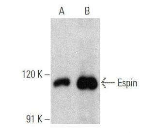 Espin Antibody (E-7) - Western Blotting - Image 356206Each CRISPR/Cas9 Knockout (KO) Plasmid product consists of a pool of 3 plasmids designed to ensure identification and cleavage of a specific gene for maximum knockout efficiency. Each plasmid encodes a unique 20 nt sequence derived from the GeCKO (v2) library.