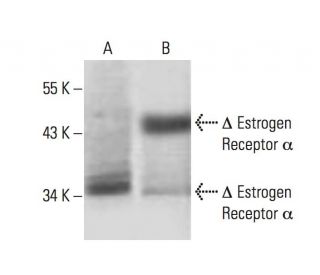 Estrogen Receptor alpha Antibody (10H12B10) - Western Blotting - Image 137477 