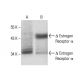 Estrogen Receptor alpha Antibody (10H12B10) - Western Blotting - Image 137477 