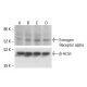 Estrogen Receptor alpha Antibody (10H12B10) - Western Blotting - Image 412125